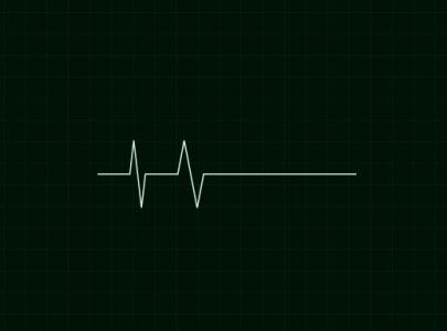 基于JavaScript制作的SVG心脏监测器